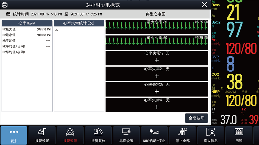 24小時心電概覽